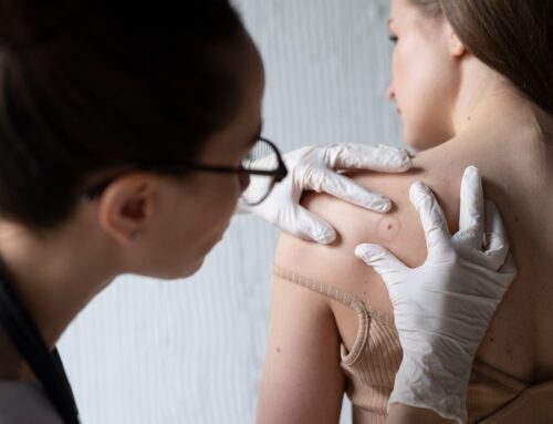 The Importance of Regular Skin Examinations